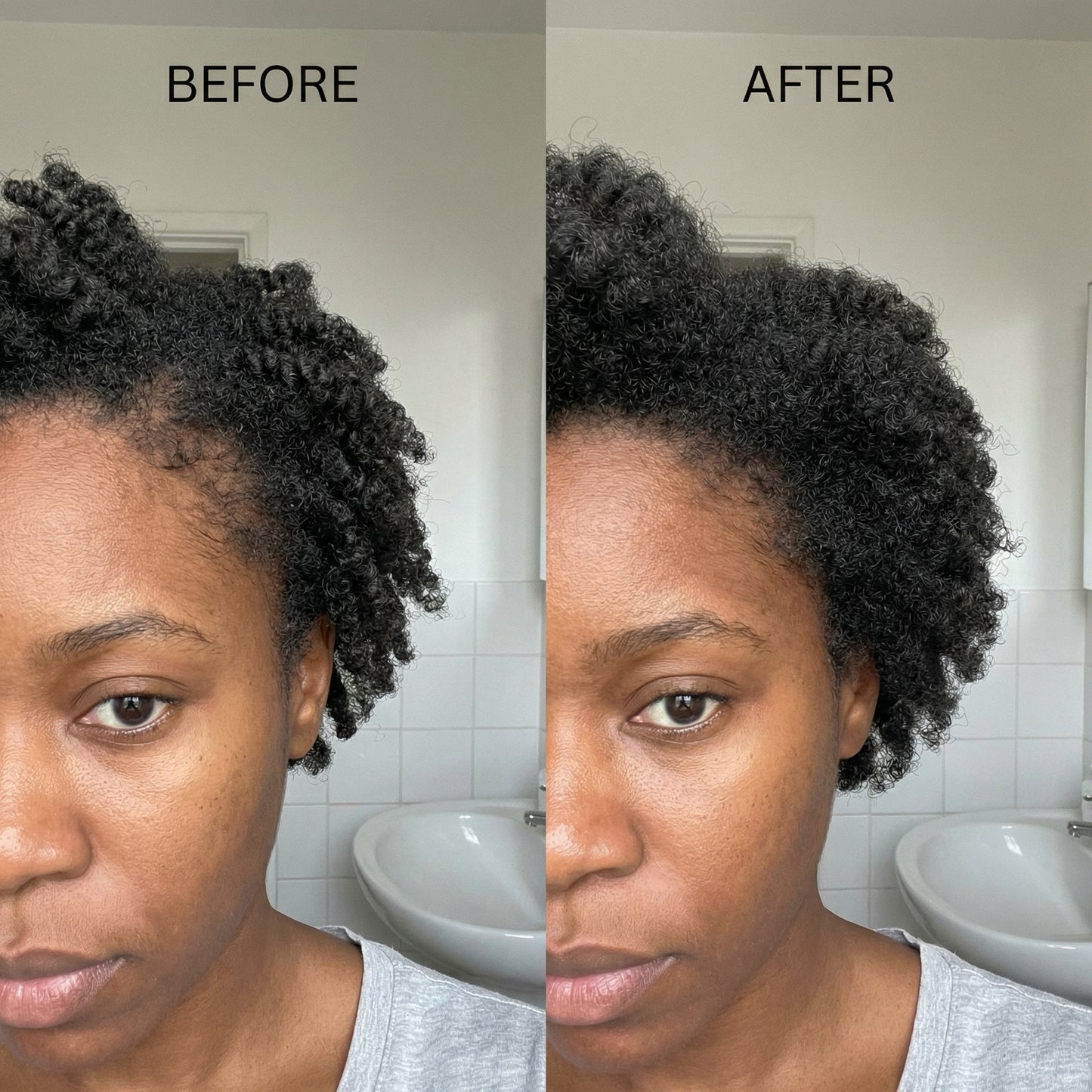 Postpartum Hair Recovery Oil